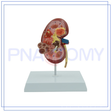 PNT-0739 China manufacturer human kidney section model with best price